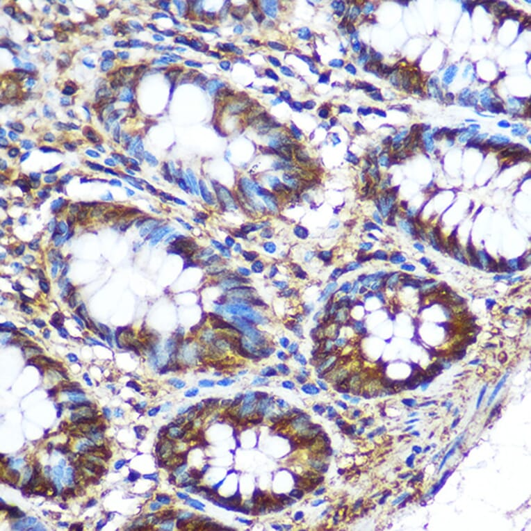 Immunohistochemistry - Anti-PKM Antibody (A90814) - Antibodies.com