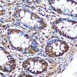 Immunohistochemistry - Anti-PKM Antibody (A90814) - Antibodies.com