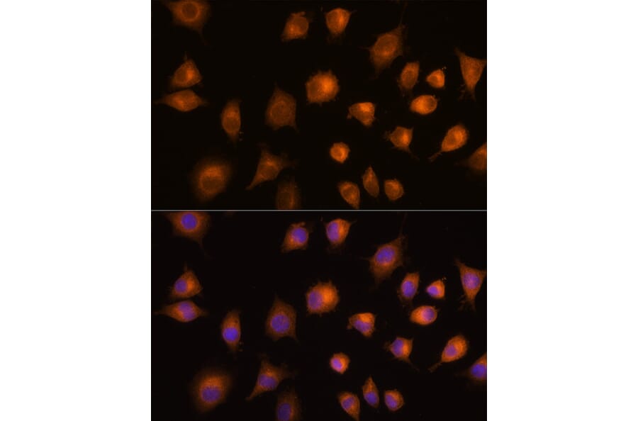 Immunofluorescence - Anti-PKM Antibody (A90814) - Antibodies.com