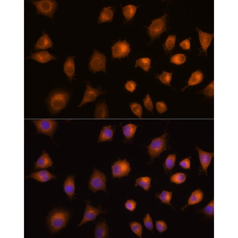Immunofluorescence - Anti-PKM Antibody (A90814) - Antibodies.com