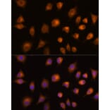 Immunofluorescence - Anti-PKM Antibody (A90814) - Antibodies.com
