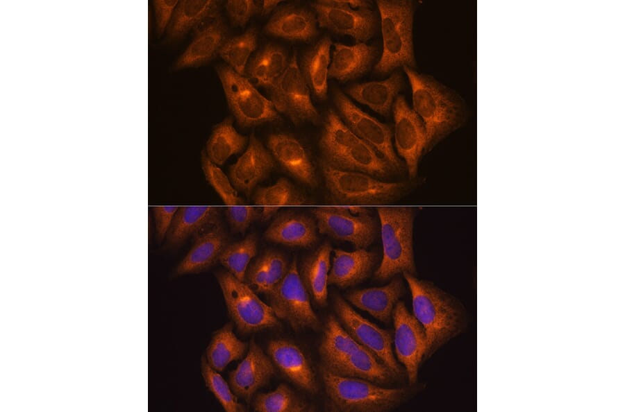Immunofluorescence - Anti-PKM Antibody (A90814) - Antibodies.com