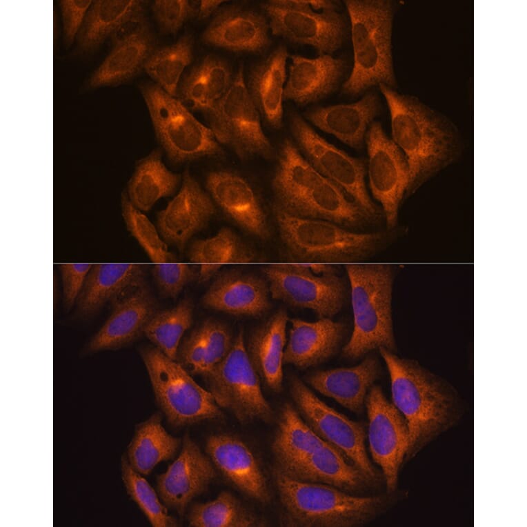 Immunofluorescence - Anti-PKM Antibody (A90814) - Antibodies.com