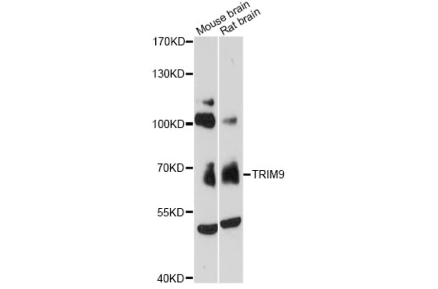 Western Blot - Anti-TRIM9 Antibody (A13895) - Antibodies.com