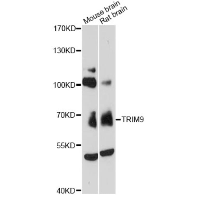 Western Blot - Anti-TRIM9 Antibody (A13895) - Antibodies.com