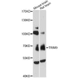 Western Blot - Anti-TRIM9 Antibody (A13895) - Antibodies.com