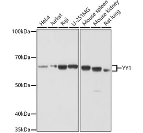 Western Blot - Anti-YY1 Antibody (A90816) - Antibodies.com