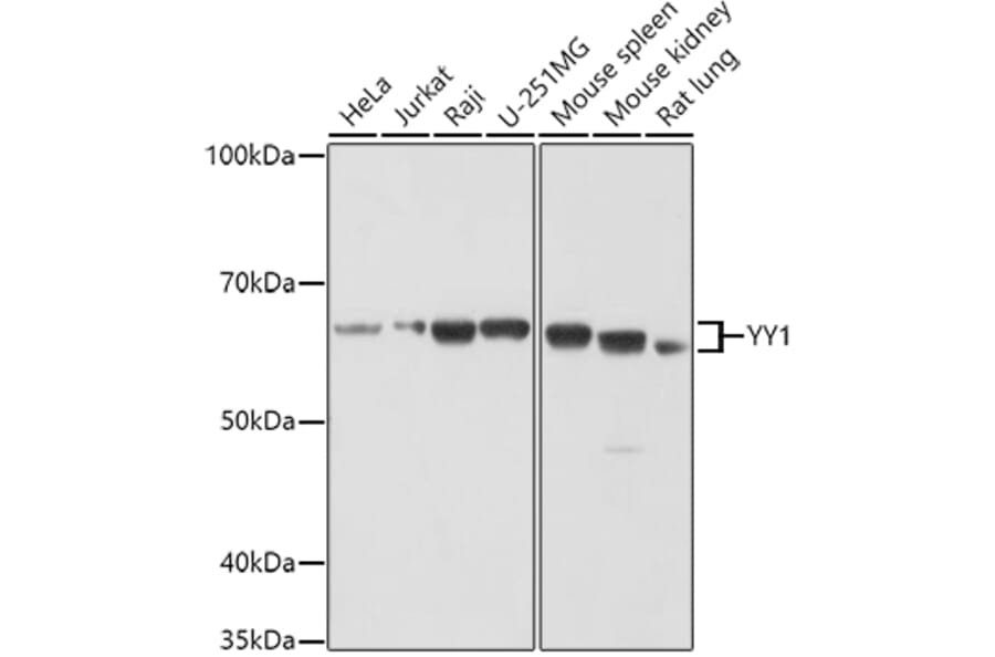 Western Blot - Anti-YY1 Antibody (A90816) - Antibodies.com