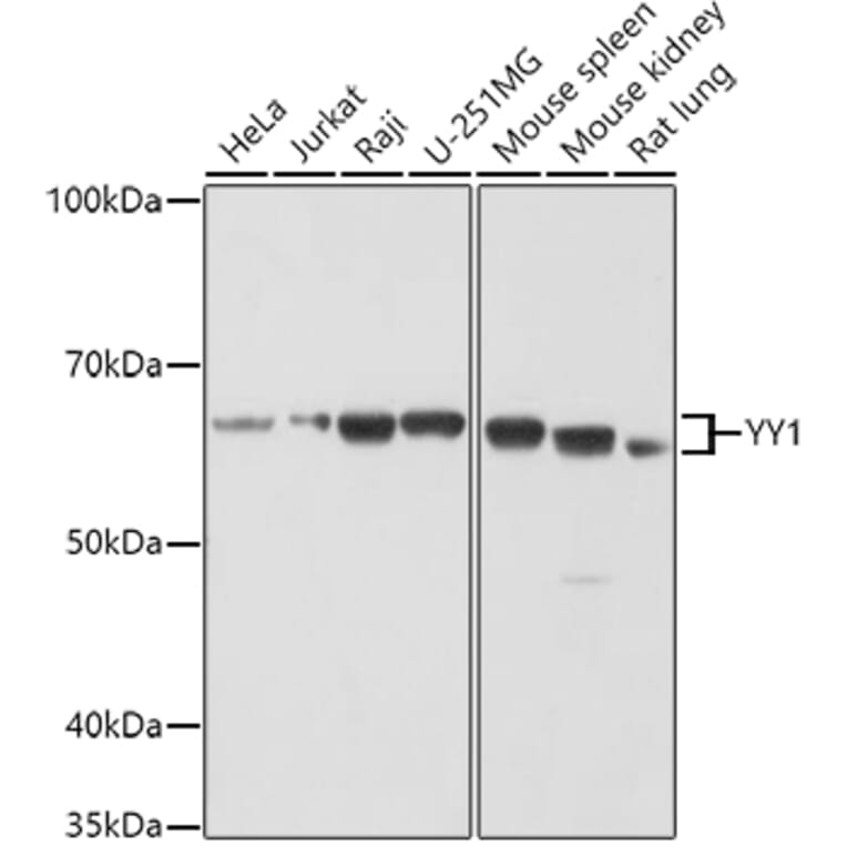 Western Blot - Anti-YY1 Antibody (A90816) - Antibodies.com