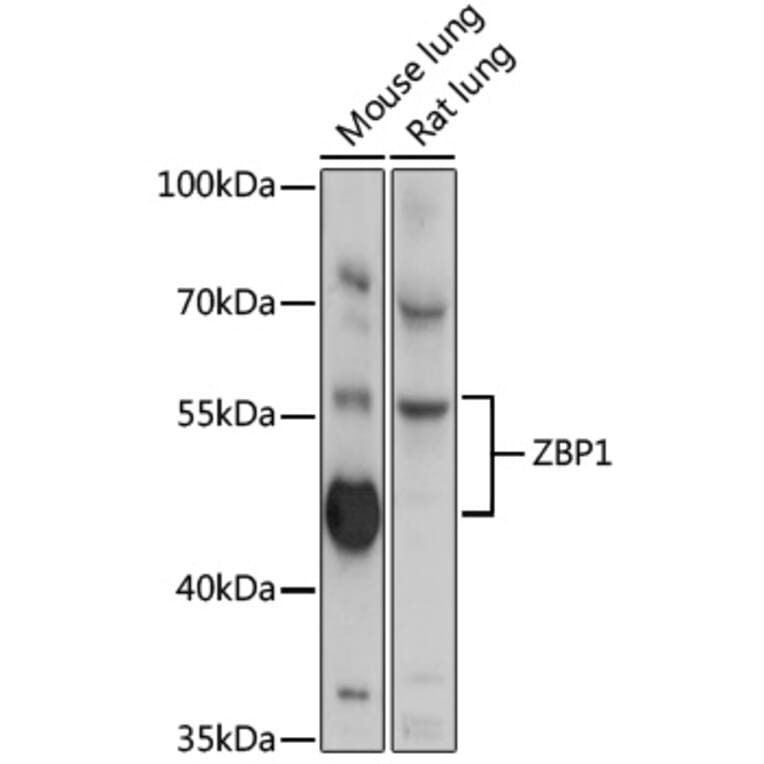 Western Blot - Anti-DAI Antibody (A90817) - Antibodies.com