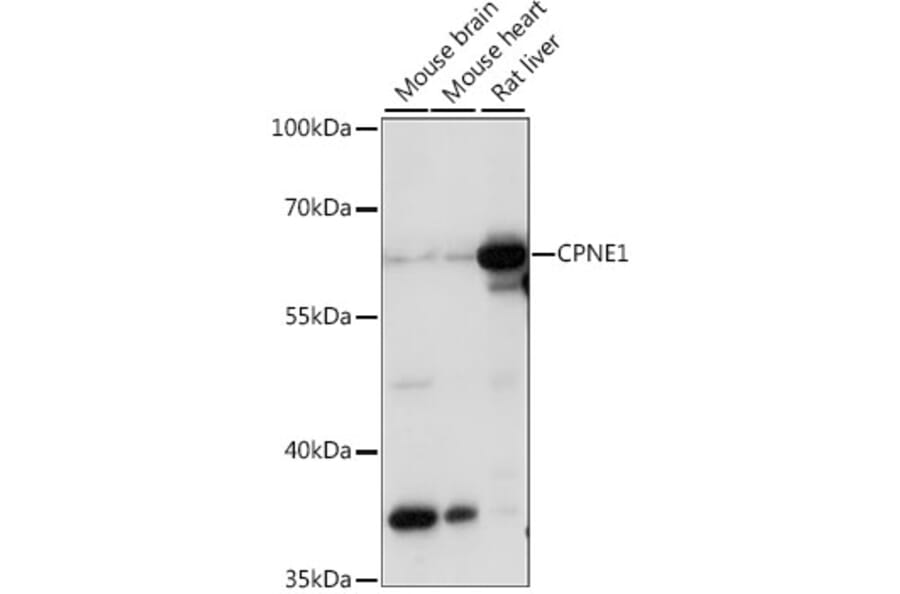 Western Blot - Anti-CPNE1 Antibody (A90818) - Antibodies.com