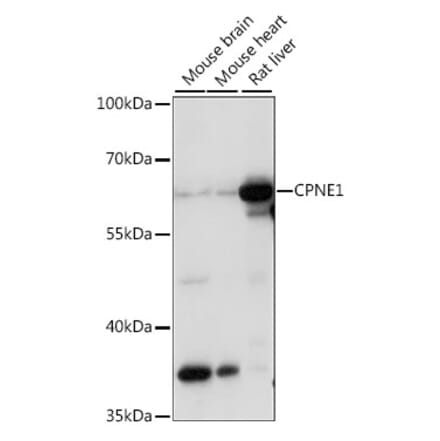 Western Blot - Anti-CPNE1 Antibody (A90818) - Antibodies.com