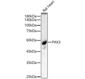 Western Blot - Anti-PAX3 Antibody (A90819) - Antibodies.com