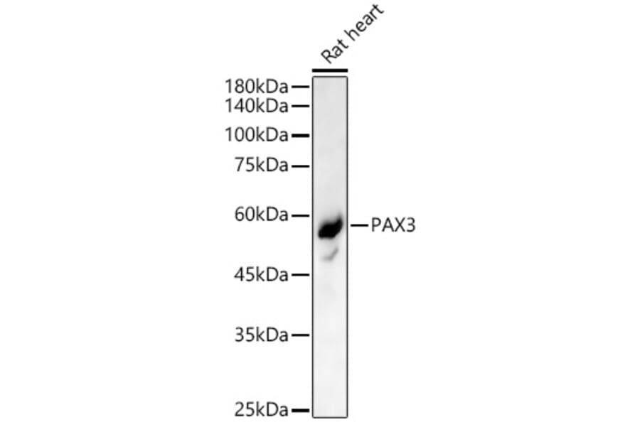Western Blot - Anti-PAX3 Antibody (A90819) - Antibodies.com