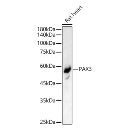 Western Blot - Anti-PAX3 Antibody (A90819) - Antibodies.com
