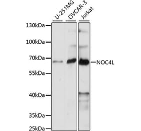 Western Blot - Anti-NOC4L Antibody (A90820) - Antibodies.com