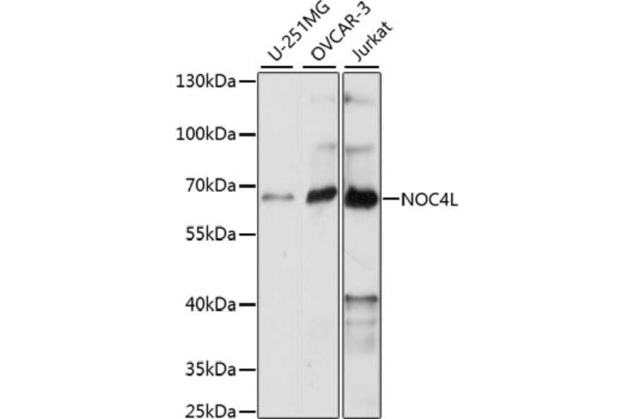 Western Blot - Anti-NOC4L Antibody (A90820) - Antibodies.com
