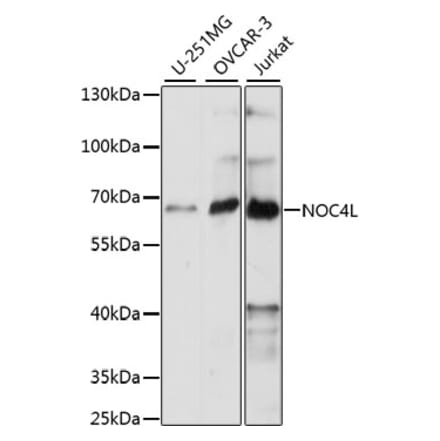 Western Blot - Anti-NOC4L Antibody (A90820) - Antibodies.com
