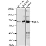 Western Blot - Anti-NOC4L Antibody (A90820) - Antibodies.com