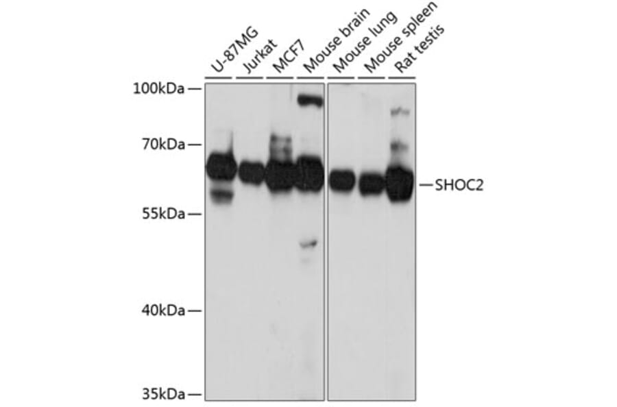 Western Blot - Anti-Shoc2/Sur8 Antibody (A90821) - Antibodies.com