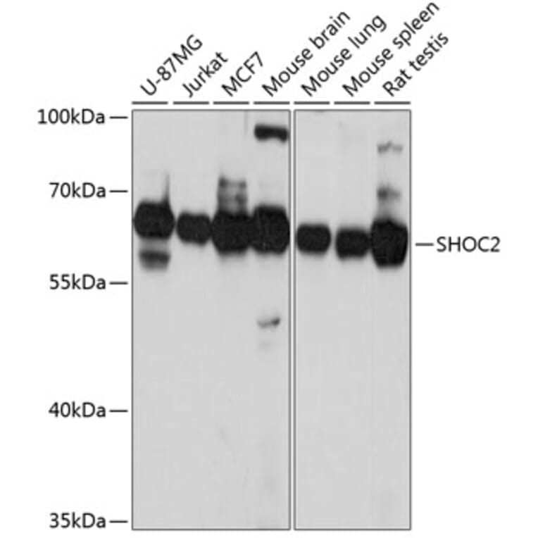 Western Blot - Anti-Shoc2/Sur8 Antibody (A90821) - Antibodies.com