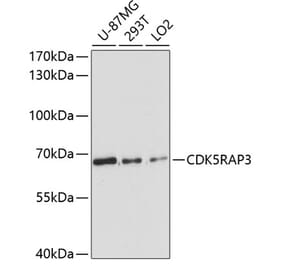 Western Blot - Anti-CDK5RAP3 Antibody (A90822) - Antibodies.com