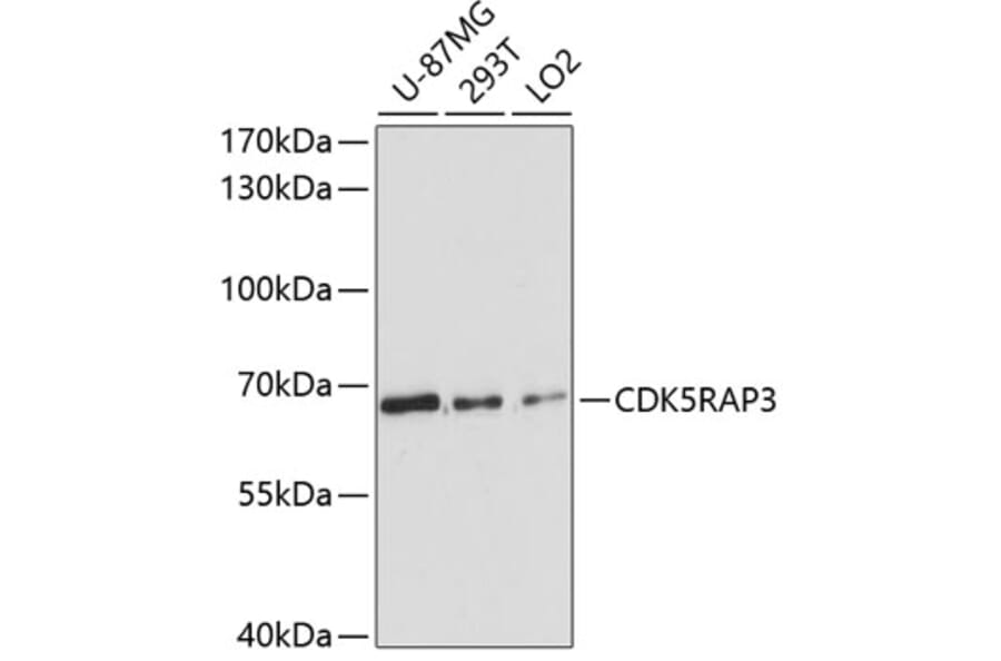 Western Blot - Anti-CDK5RAP3 Antibody (A90822) - Antibodies.com