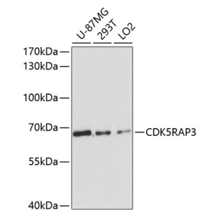 Western Blot - Anti-CDK5RAP3 Antibody (A90822) - Antibodies.com