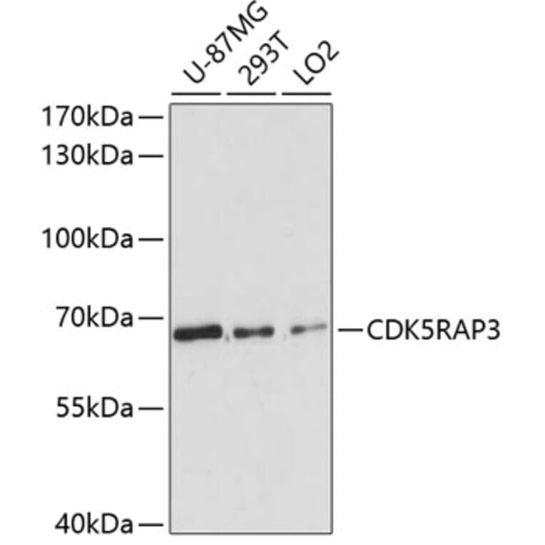 Western Blot - Anti-CDK5RAP3 Antibody (A90822) - Antibodies.com