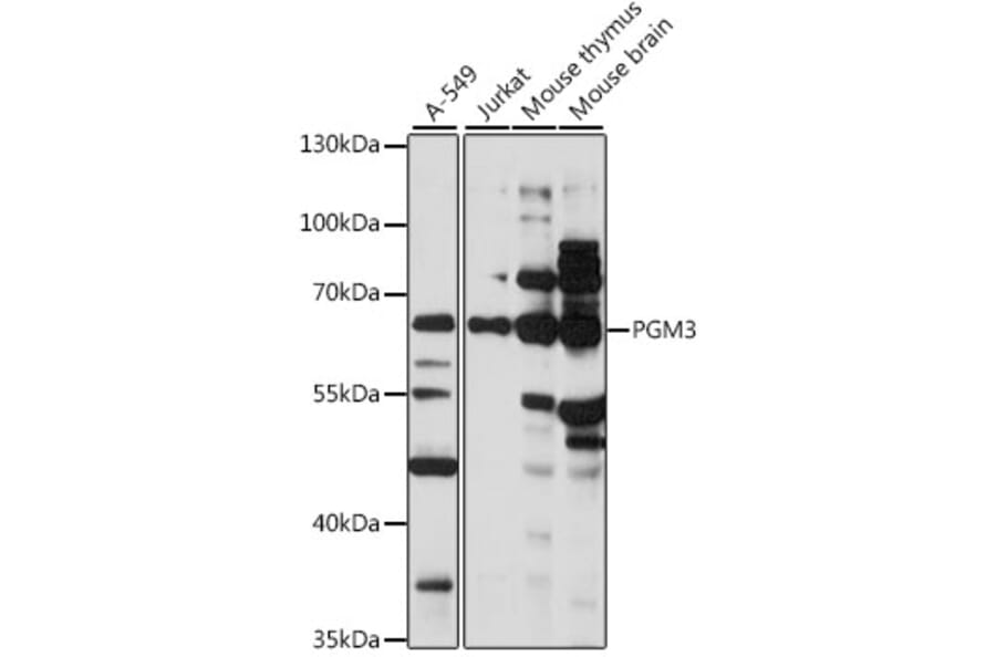 Western Blot - Anti-PGM3 Antibody (A90824) - Antibodies.com