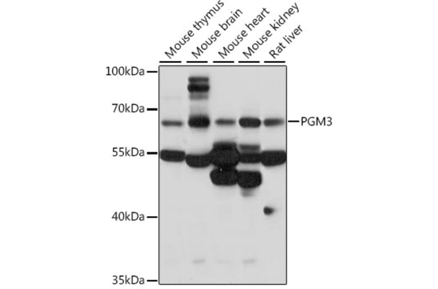 Western Blot - Anti-PGM3 Antibody (A90825) - Antibodies.com