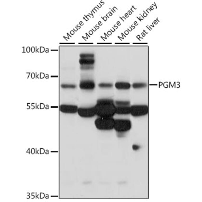 Western Blot - Anti-PGM3 Antibody (A90825) - Antibodies.com
