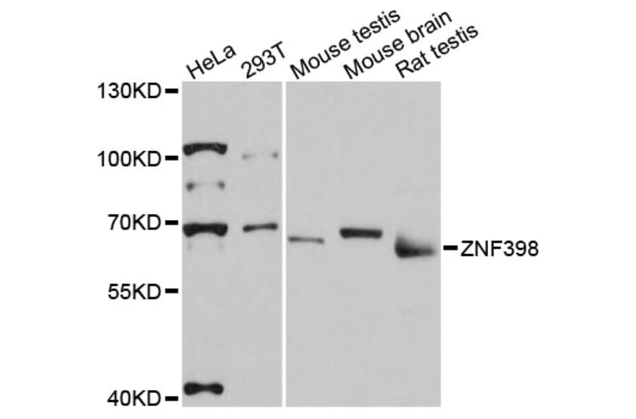 Western Blot - Anti-ZNF398 Antibody (A13778) - Antibodies.com