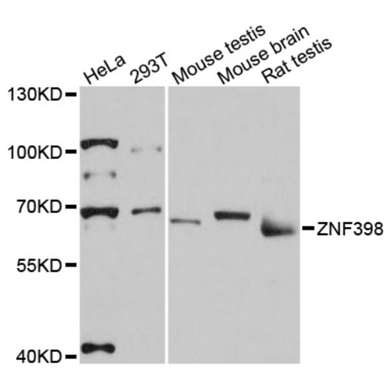 Western Blot - Anti-ZNF398 Antibody (A13778) - Antibodies.com