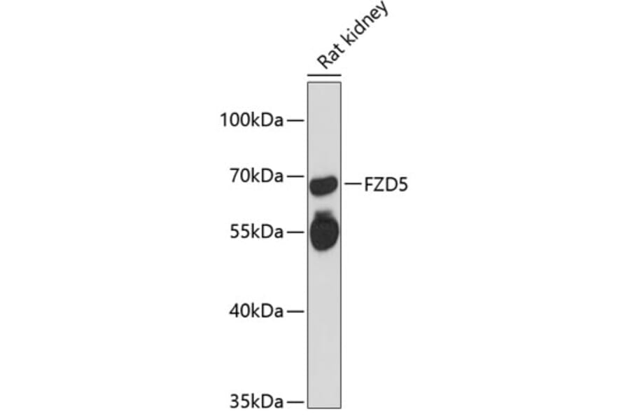 Western Blot - Anti-Frizzled 5 Antibody (A90827) - Antibodies.com