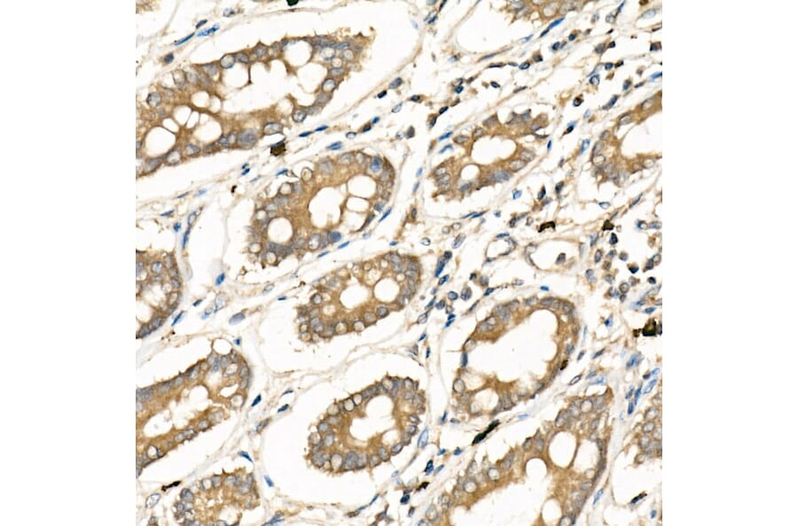 Immunohistochemistry - Anti-Frizzled 5 Antibody (A90827) - Antibodies.com