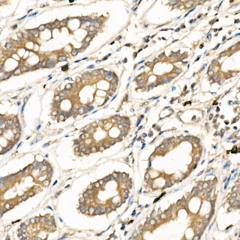 Immunohistochemistry - Anti-Frizzled 5 Antibody (A90827) - Antibodies.com