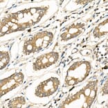 Immunohistochemistry - Anti-Frizzled 5 Antibody (A90827) - Antibodies.com