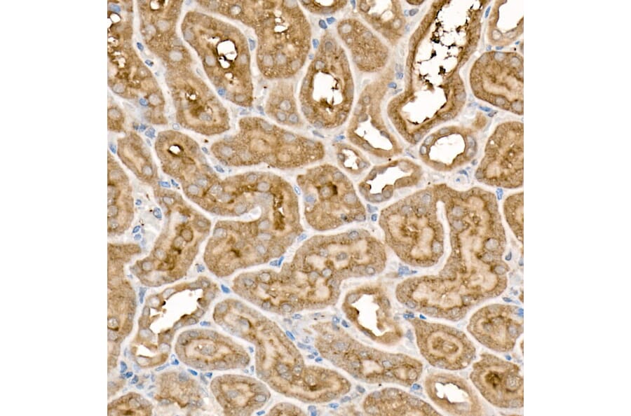 Immunohistochemistry - Anti-Frizzled 5 Antibody (A90827) - Antibodies.com