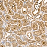 Immunohistochemistry - Anti-Frizzled 5 Antibody (A90827) - Antibodies.com