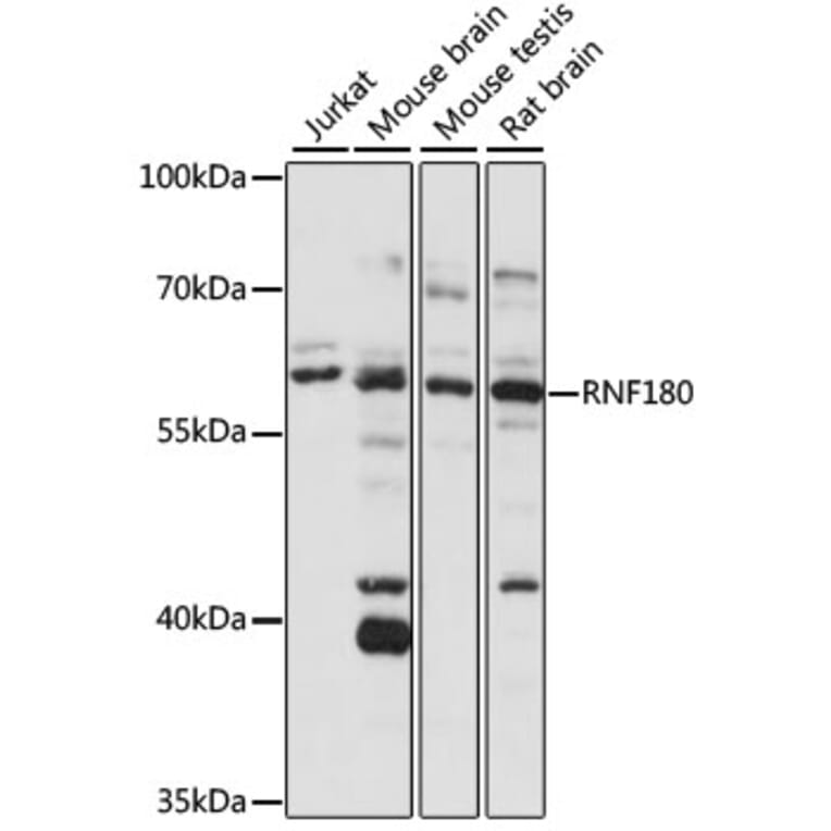Western Blot - Anti-RNF180 Antibody (A90828) - Antibodies.com