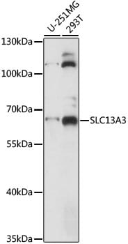 Western blot analysis of extracts of various cell lines, using Anti-SLC13A3 Antibody (A15183) at 1:1,000 dilution.
Secondary antibody: Goat Anti-Rabbit IgG (H+L) (HRP) (AS014) at 1:10,000 dilution.
Lysates / proteins: 25µg per lane.
Blocking buffer: 3% non-fat dry milk in TBST.
Detection: ECL Basic Kit (RM00020).
Exposure time: 5s.