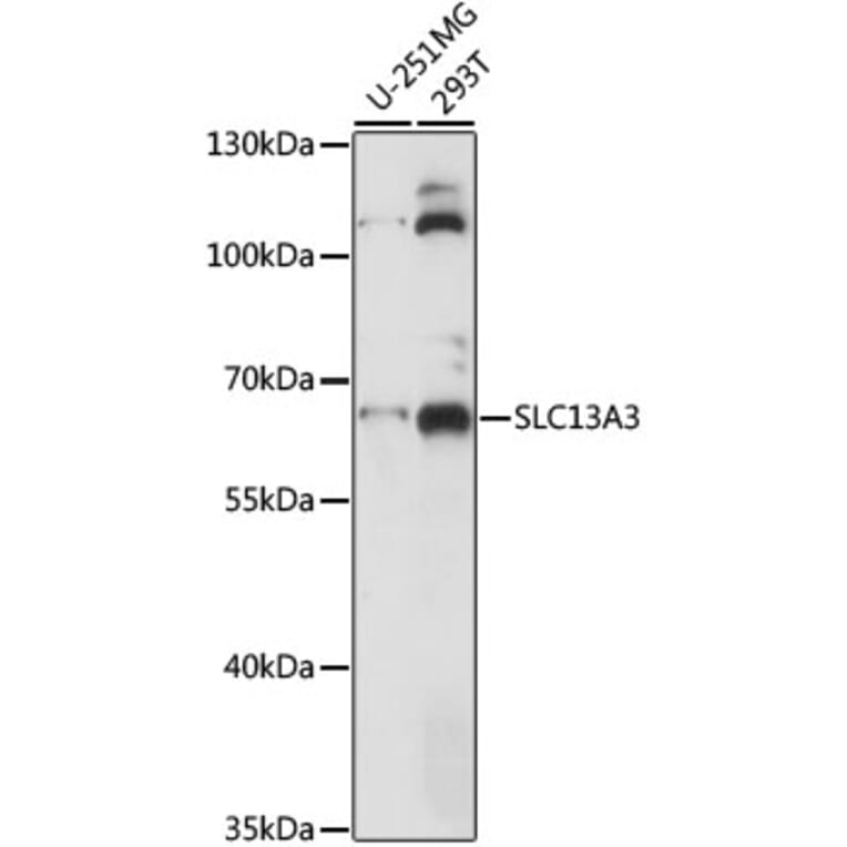 Western Blot - Anti-NaDC-3 Antibody (A90829) - Antibodies.com