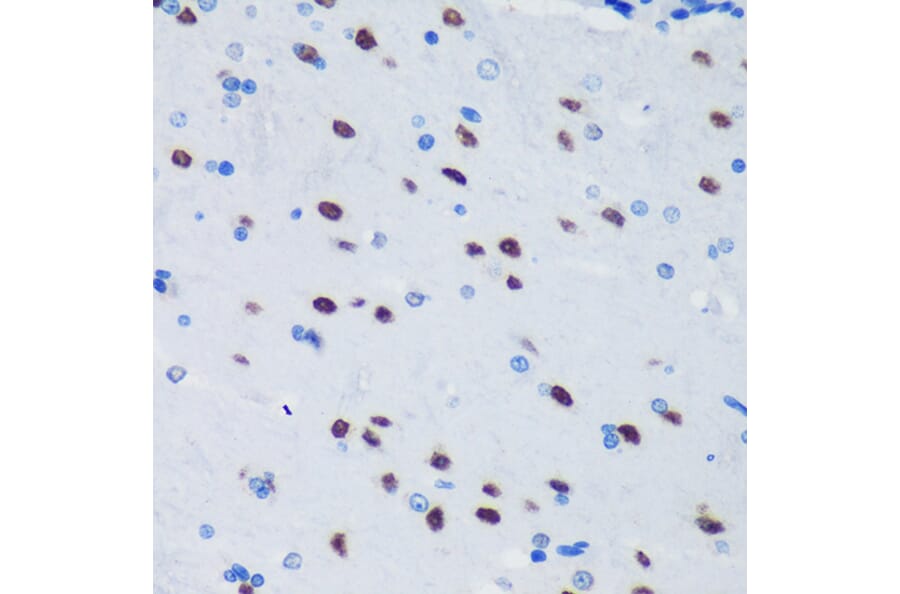 Immunohistochemistry - Anti-PSPC1 Antibody (A90831) - Antibodies.com