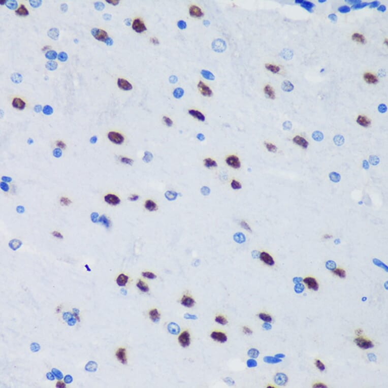 Immunohistochemistry - Anti-PSPC1 Antibody (A90831) - Antibodies.com