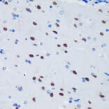 Immunohistochemistry - Anti-PSPC1 Antibody (A90831) - Antibodies.com