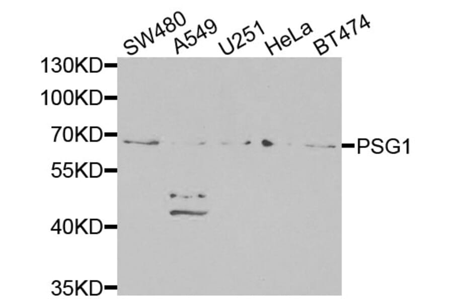 Western Blot - Anti-PSG1 Antibody (A13533) - Antibodies.com