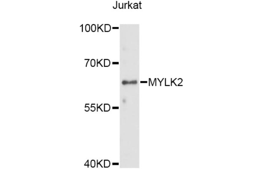 Western Blot - Anti-MYLK2 Antibody (A14295) - Antibodies.com