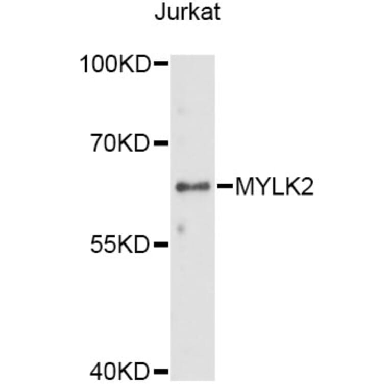 Western Blot - Anti-MYLK2 Antibody (A14295) - Antibodies.com