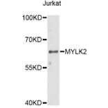 Western Blot - Anti-MYLK2 Antibody (A14295) - Antibodies.com